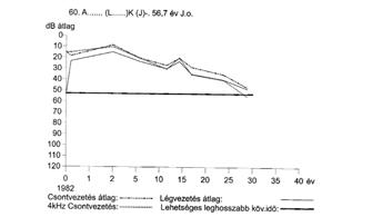 A stapes-pótló autogén corticalis csontcolumellákkal elért hosszú távú eredmények